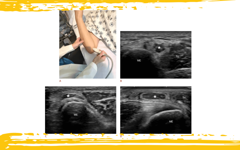 6. Diagnostico diferencial parte 1 ecografia tempo formacion.png